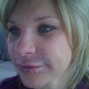 DAY AFTER INJ