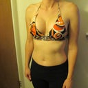 2 weeks post-op!