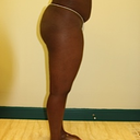 Before pic #1