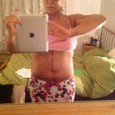 Post op 21 days