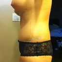 20 days po(1 more day and its 3 weeks! )