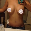 Put cupcakes on them lol. Nipple still not even, gonna ask my PS tomorrow about it.