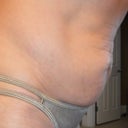 Side view before tummy tuck.