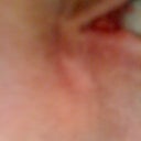 Eye bump left corner