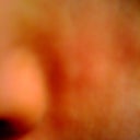 Side bumps of nose