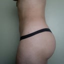 EXACTLY 4 WEEKS POST-OP 2/5/13
swelling finally going down, still some bruising on stomach though!