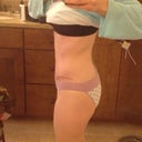 6 weeks postop