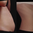 amazing results!!!
