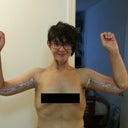 This was about 1.5 weeks post op. I wasn't feeling great, but I knew my arms look good!