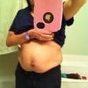 day before surgery picture