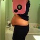 before surgery