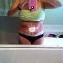 belly button still healing
