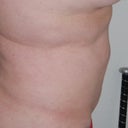Another angle before surgery