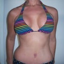 3 weeks post op!