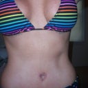 3 weeks post op