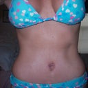 3 weeks post op