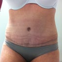 6 weeks PO