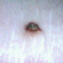 3 weeks after surgery and stitches removed from TT incision and belly button. BB looks normal! Thank goodness!