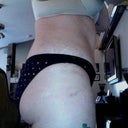 3 weeks after surgery and stitches removed from TT incision and belly button. BB looks normal! Thank goodness!