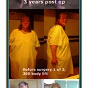 Before and after dressed