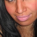 Pre op frontal view