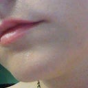 After - 2 weeks
