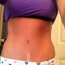 5 weeks post op