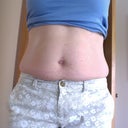 Pre-op muffin top