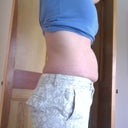 Pre-op muffin top