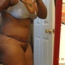 side view 4 days post op