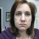 1 day after, jowl swelling like chimpmunk