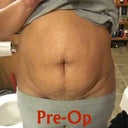 Pre-Op