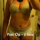 Post Op - 3 months