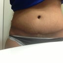 9 mos I'm tilting a little to one side. Thats why I'm a little uneven on the hips.