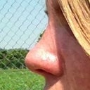 Tip to high and nostrils visible from the front