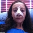 Day 2 - sorry for all of the blood on my face