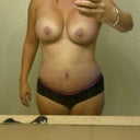 Ok there is the girls, this is 2 weeks post op.