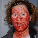 When I came home from the procedure