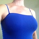 After surgery- no bra