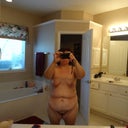 Gross!! I know!! but here it is pre op pic