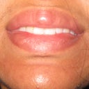 note nodules