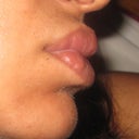 note nodules on sides