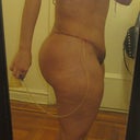3 weeks post-op...I look bigger than before with all the swelling.