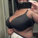 Before surgery H cup