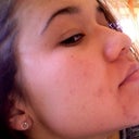 Skin starting to clear up