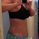 SWOLLEN at almost 5 weeks post-op. gorgeous underwear LOL