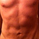 Swollen 3 months after ! normal ?