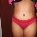 4 weeks PO revision