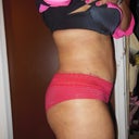 4 weeks PO revision