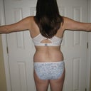 After0Approx. 2 mos.